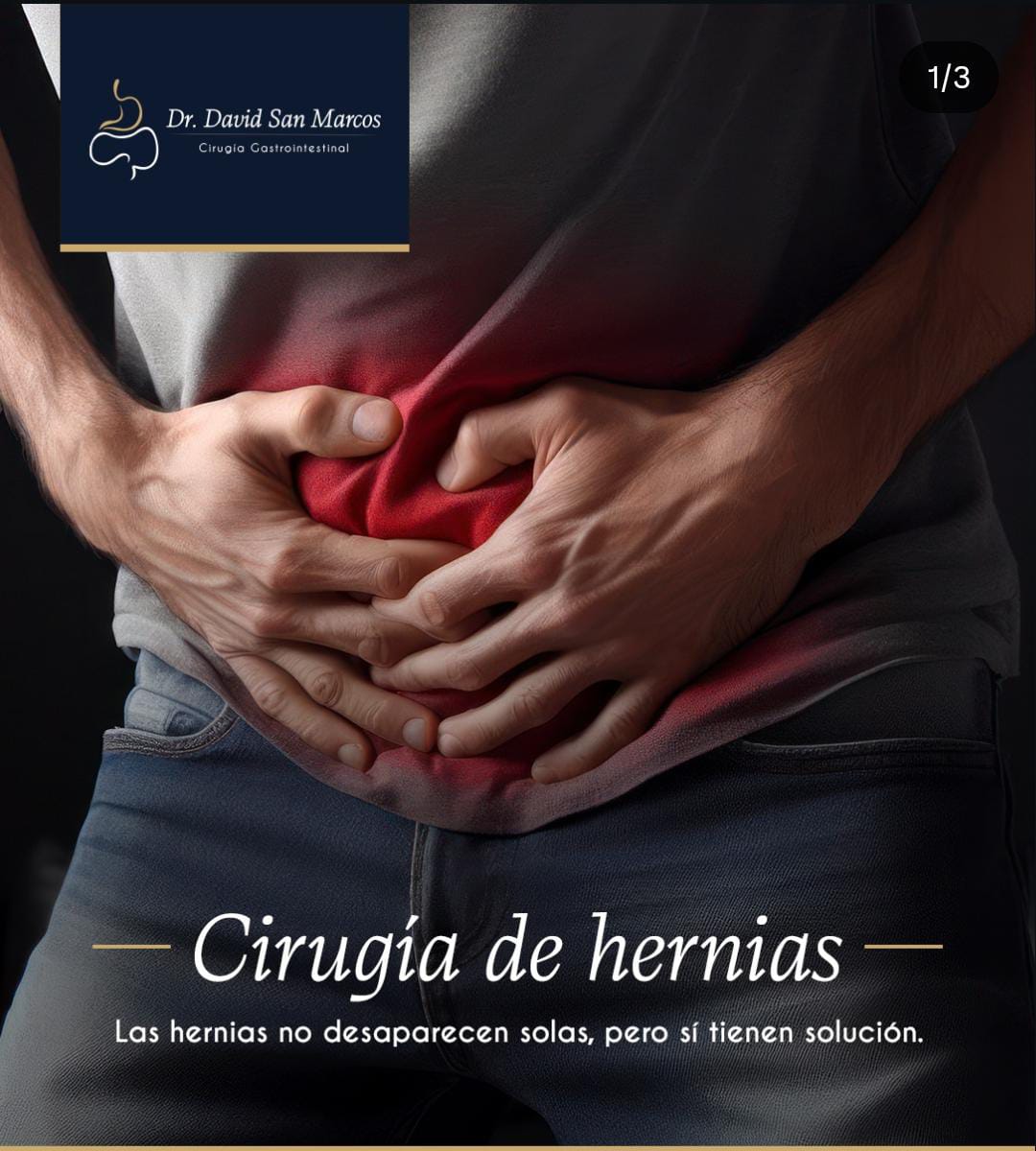 Apendicitis aguda