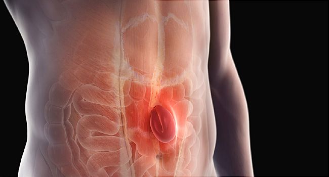 Hernias abdominales y ventrales